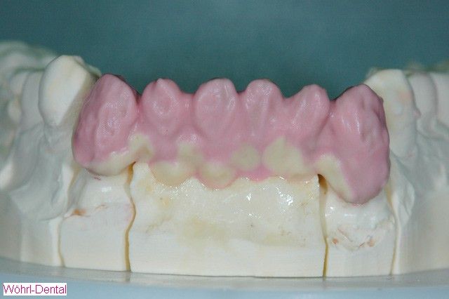 Wöhrl Dental Handarbeit