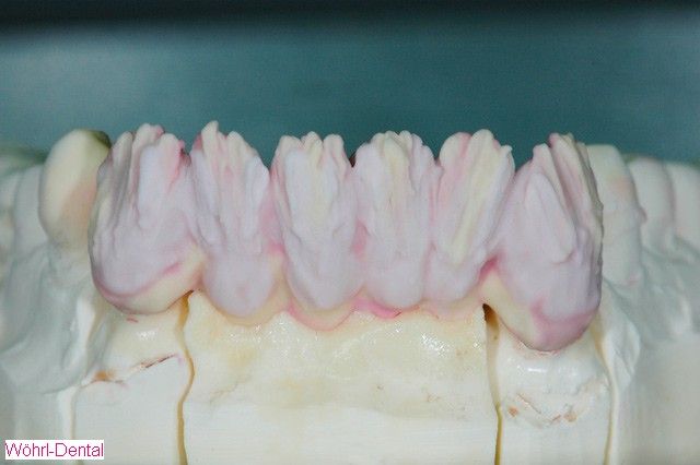 Wöhrl Dental Handarbeit