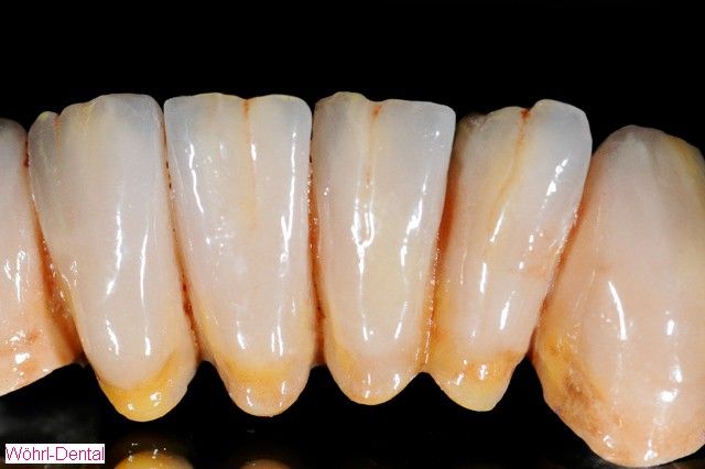 Wöhrl Dental Handarbeit