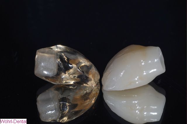 Wöhrl Dental Implantate CAD CAM